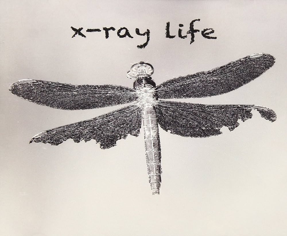 X-RAY LIFE – X-Ray Life